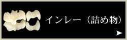審美歯科:インレー