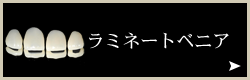 審美歯科:ラミネートベニア