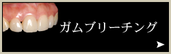 審美歯科:ガムブリーチング